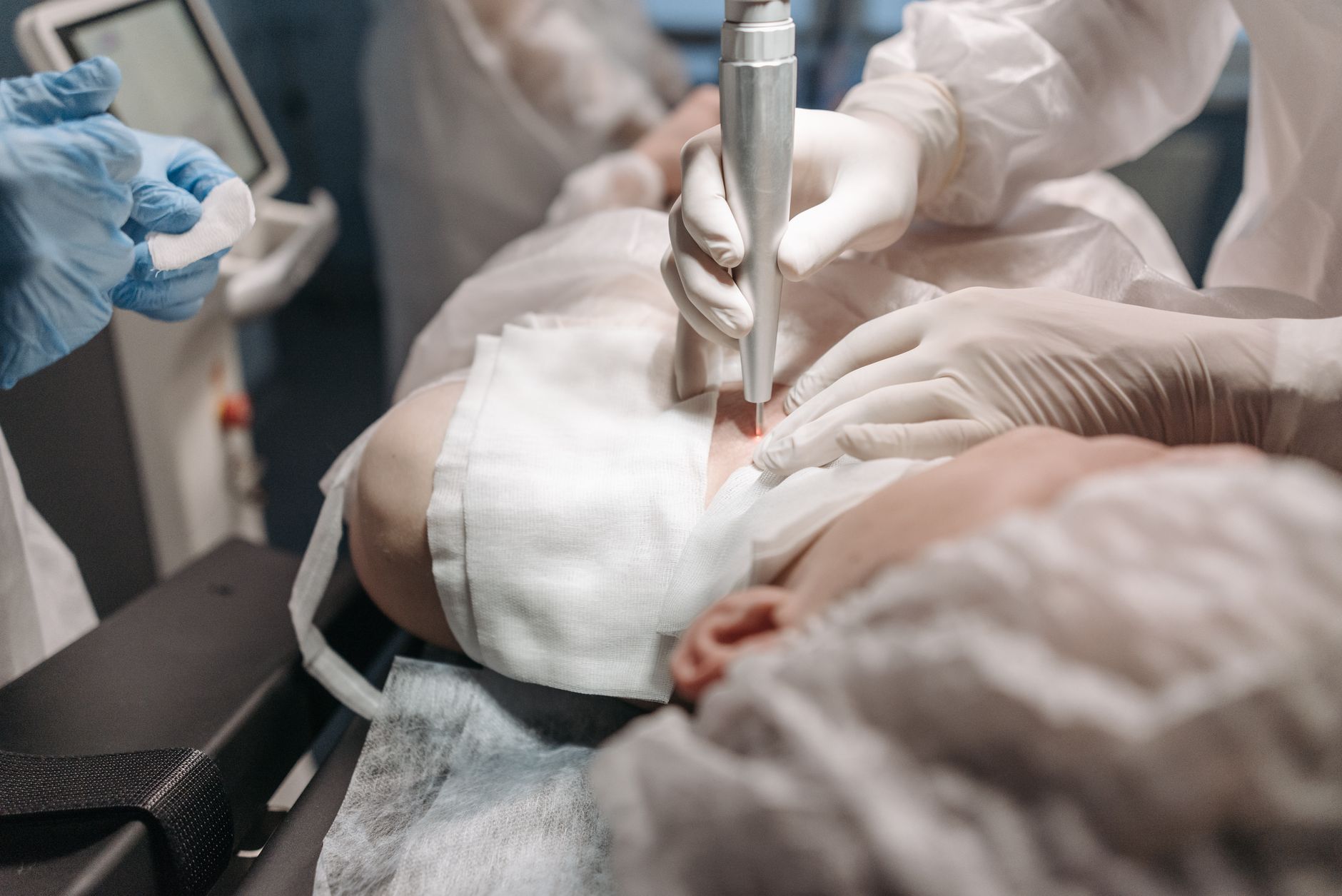 A laser handpiece being used on a draped treatment field